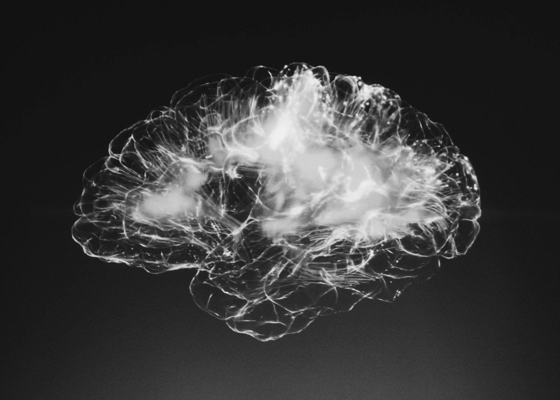 adhd brain not really